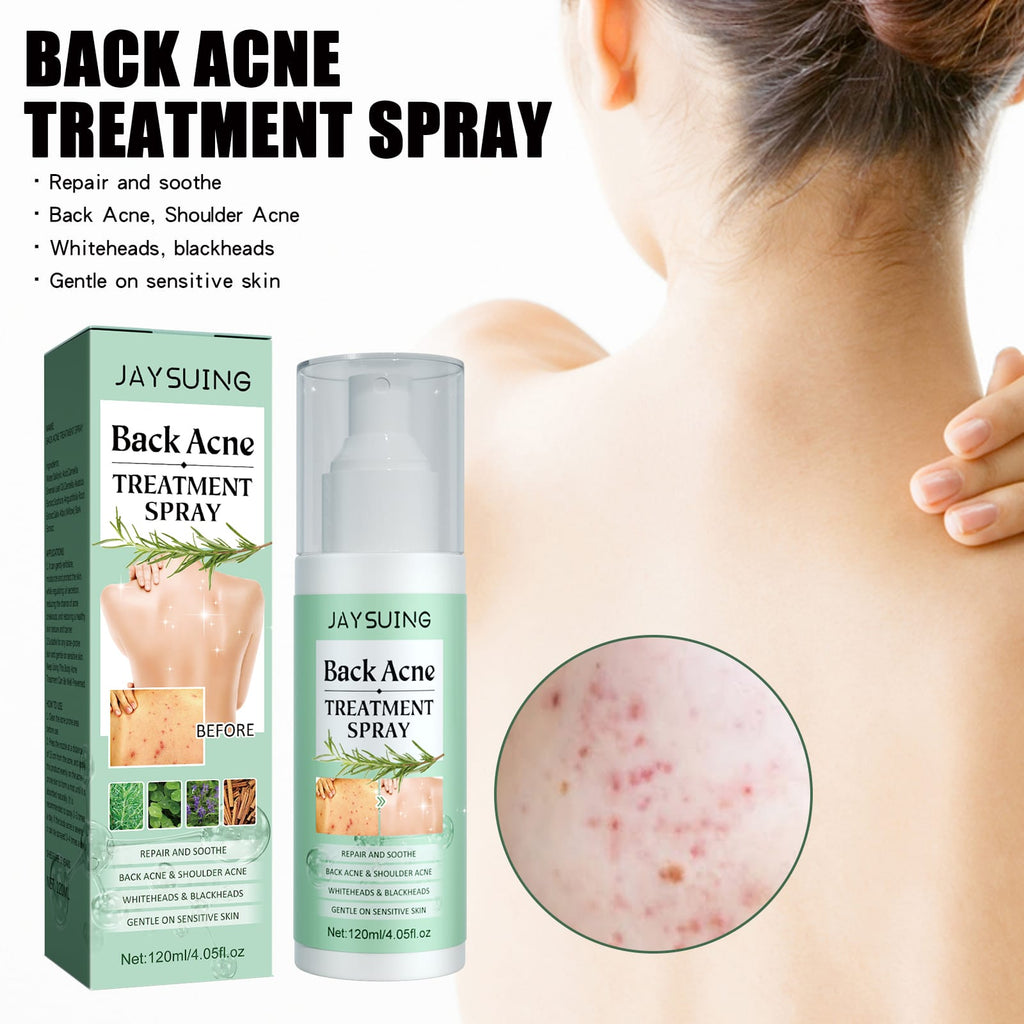 VELOUR Back Acne Repair Spray