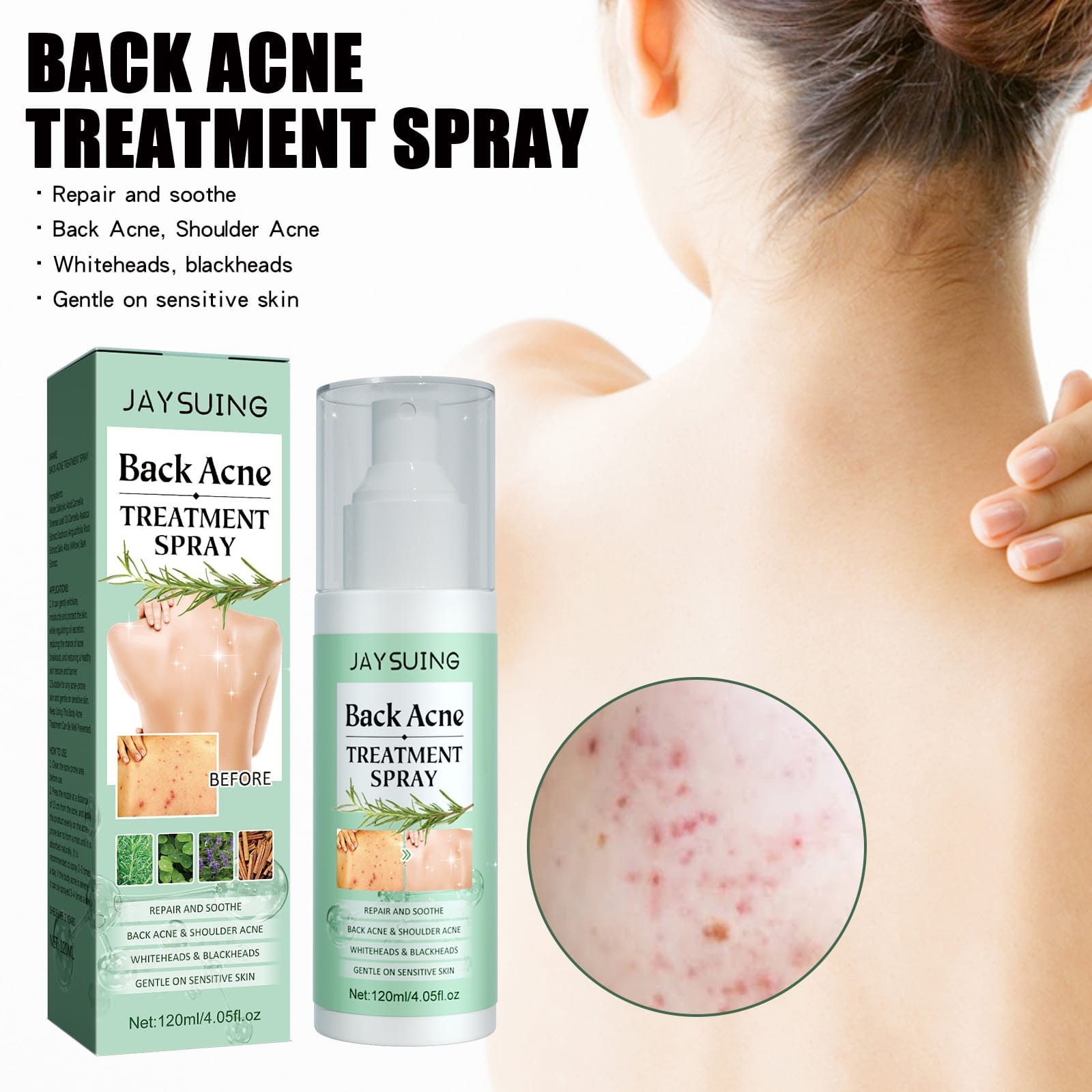 VELOUR Back Acne Repair Spray