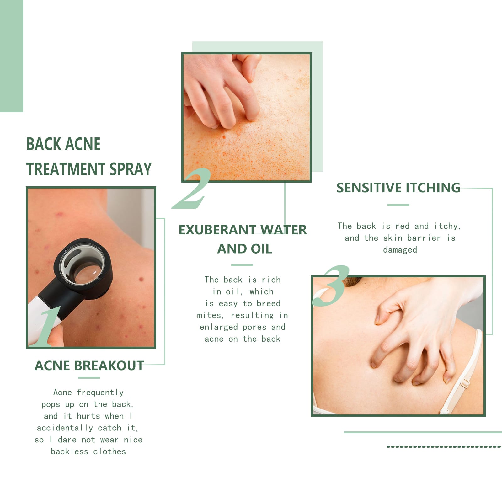 VELOUR Back Acne Repair Spray